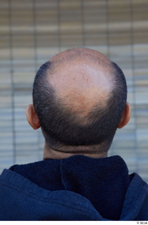 Street  801 bald hair head 0001.jpg